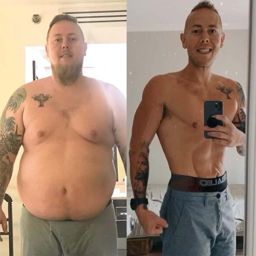 Man's selfie before and after bariatric weight transformation