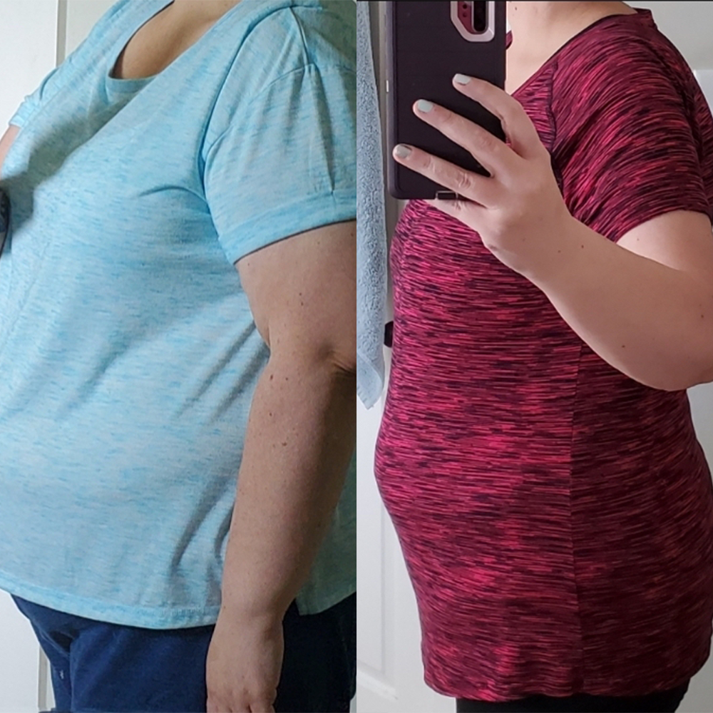 Woman's selfie before and after bariatric weight transformation