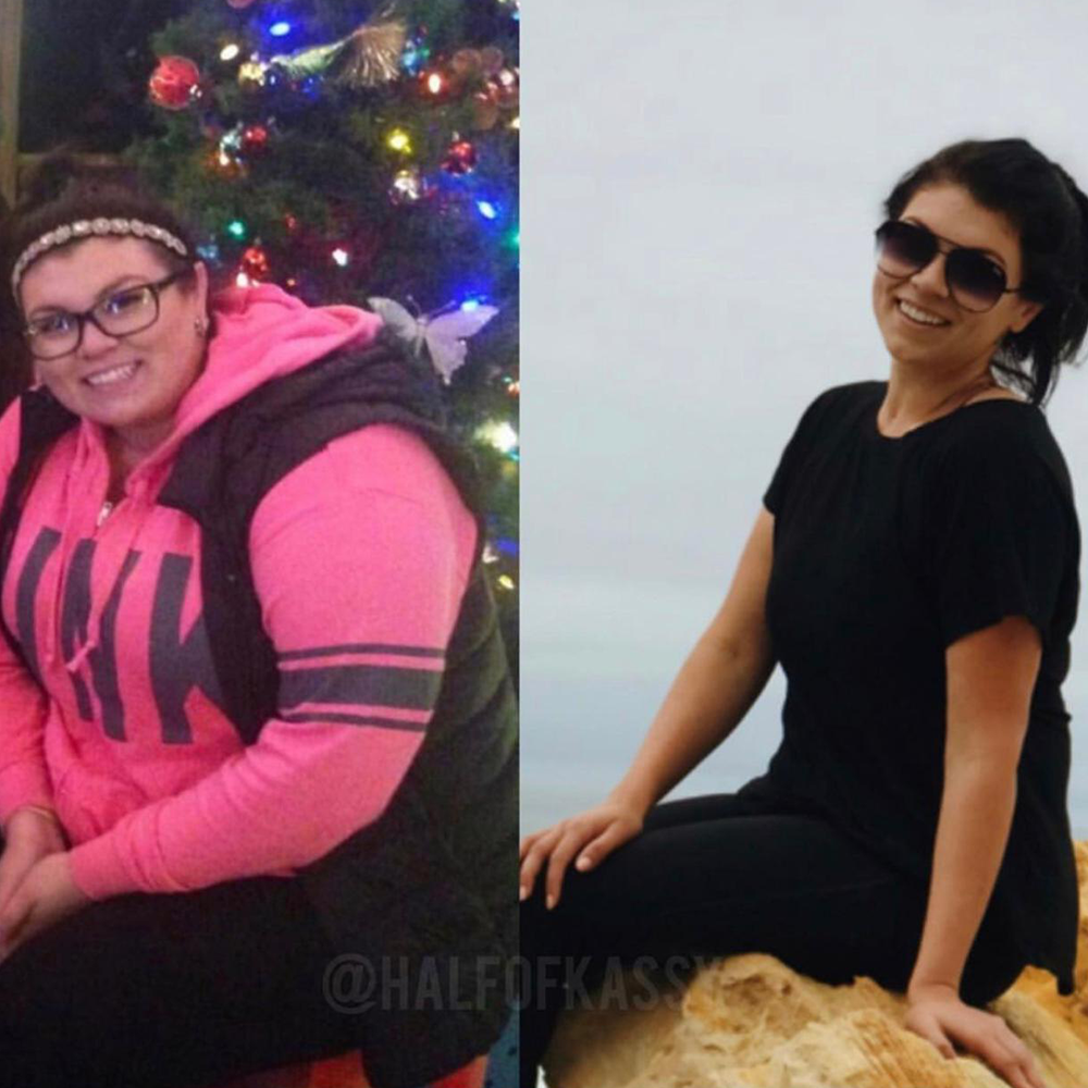 Woman's selfie before and after bariatric weight transformation