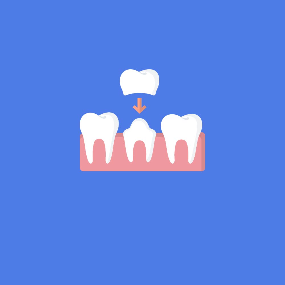 Dental Crown Icon showing crown sliding over tooth.