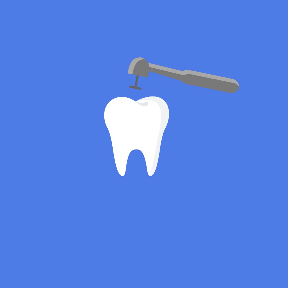 Root Canal Treatment Icon with drill in top of tooth.